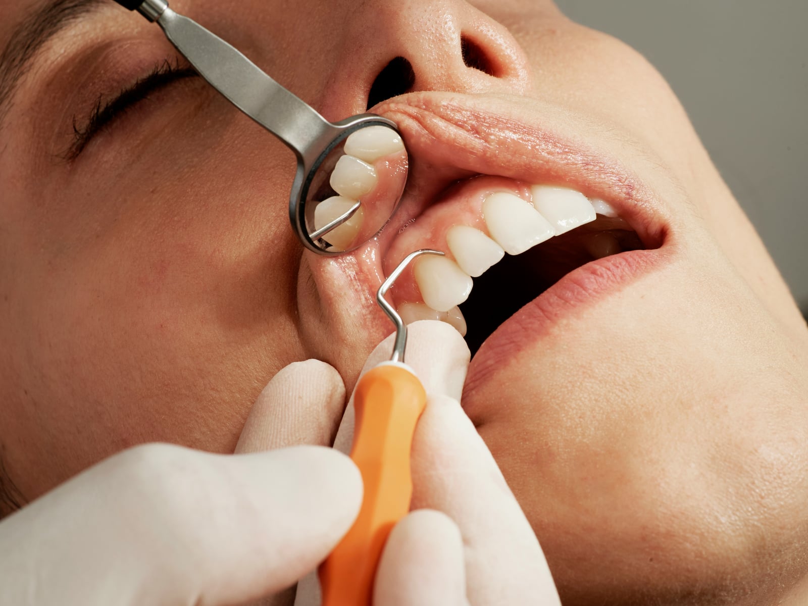 Dentist checking a patient's teeth with a mirror and scaler