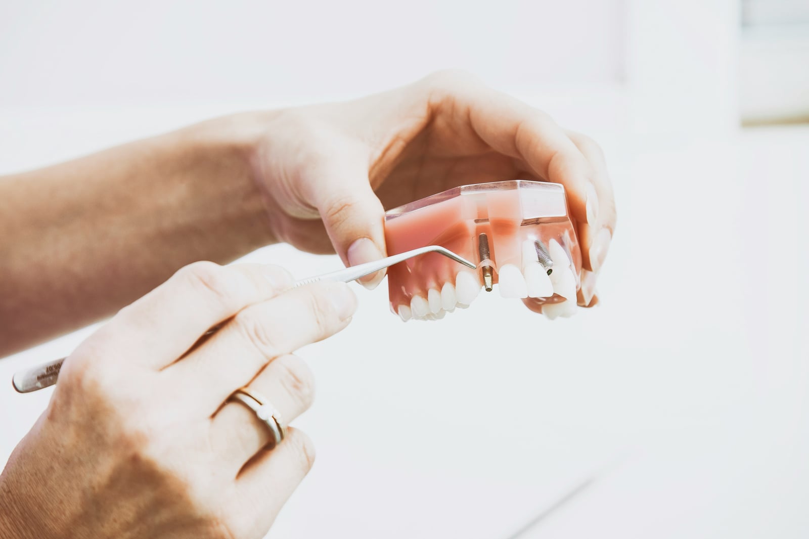 Dentist pointing out details on a denture model