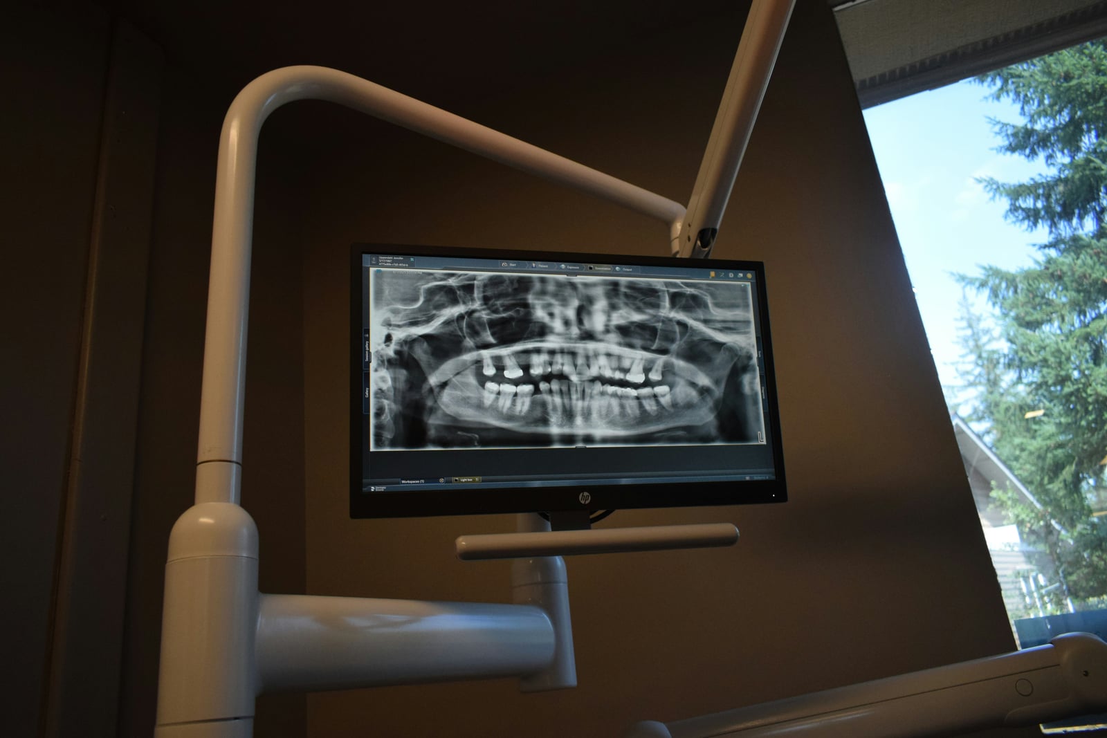 Dental X-ray displayed on the chairside monitor